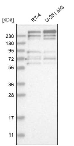 FRYL Antibody, Novus Biologicals 25 &mu;L, Unlabeled:Antibodies, Polyclonal